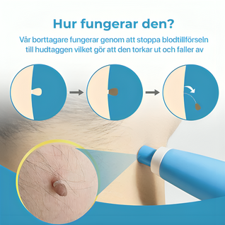 Hudfliksborttagare – Komplett kit för hemmabruk